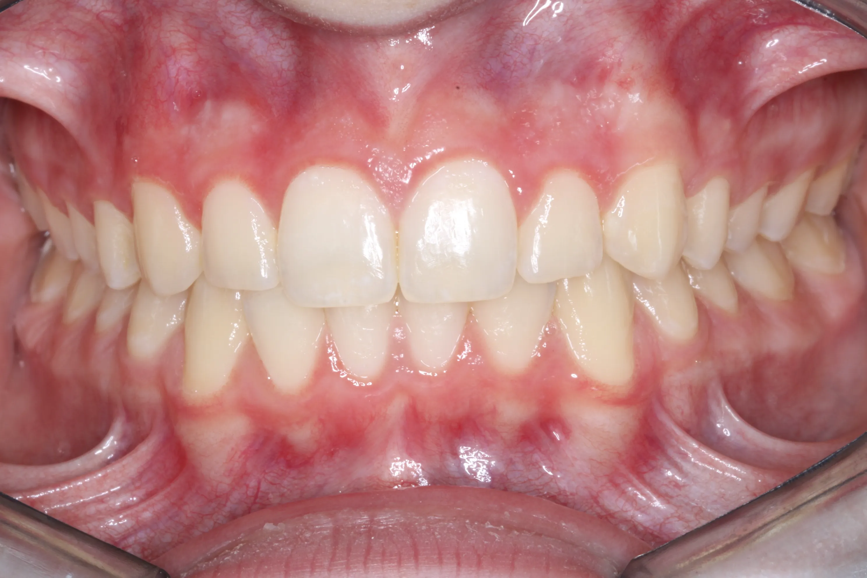 smile-gallery gallery